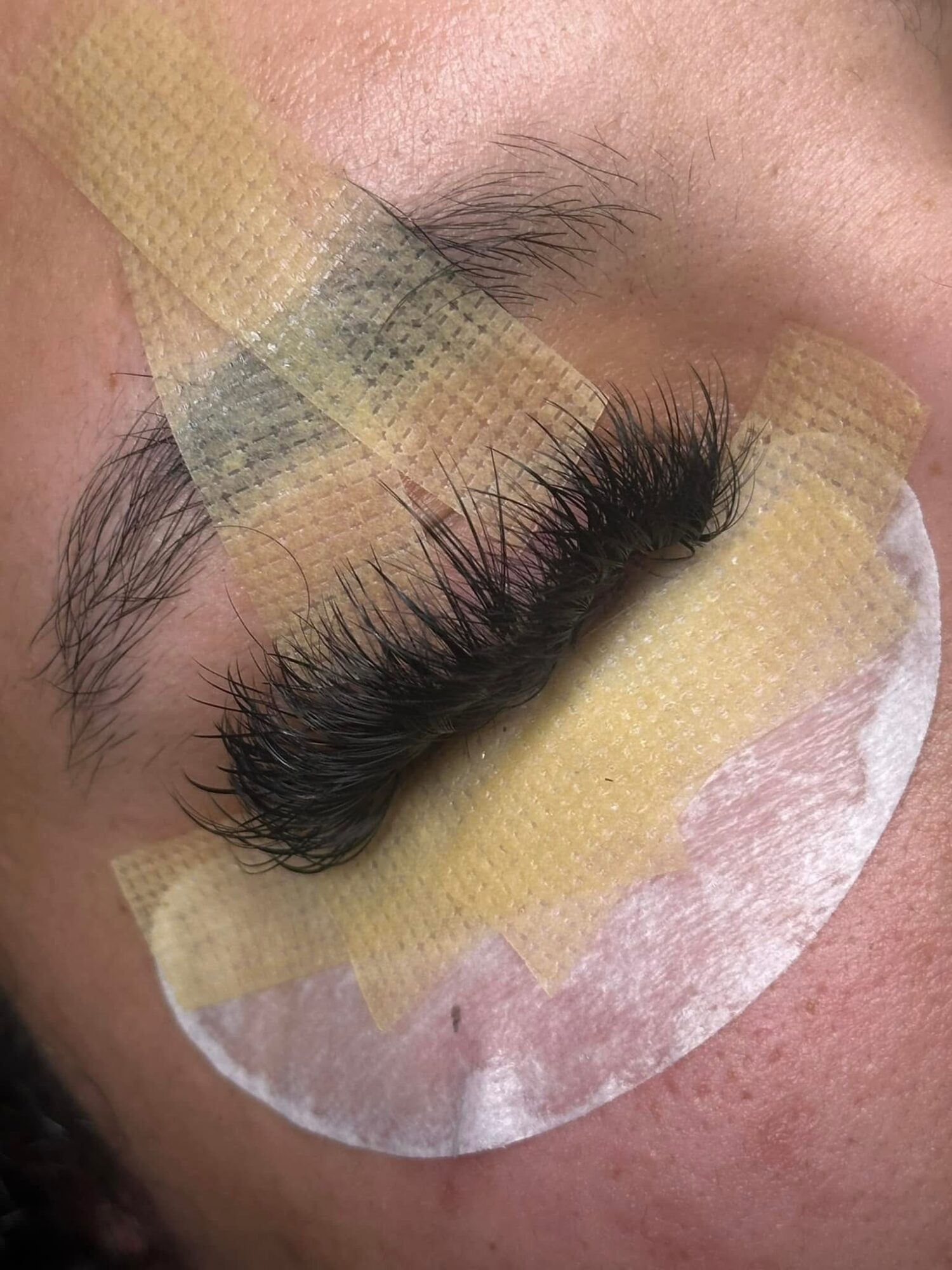 Close-up of a closed eye with long eyelashes and adhesive tape strips across the eyelid and cheek.